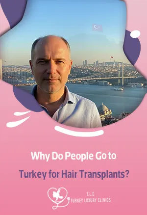 Warum gehen Menschen zur Haartransplantation in die Türkei?featured image
