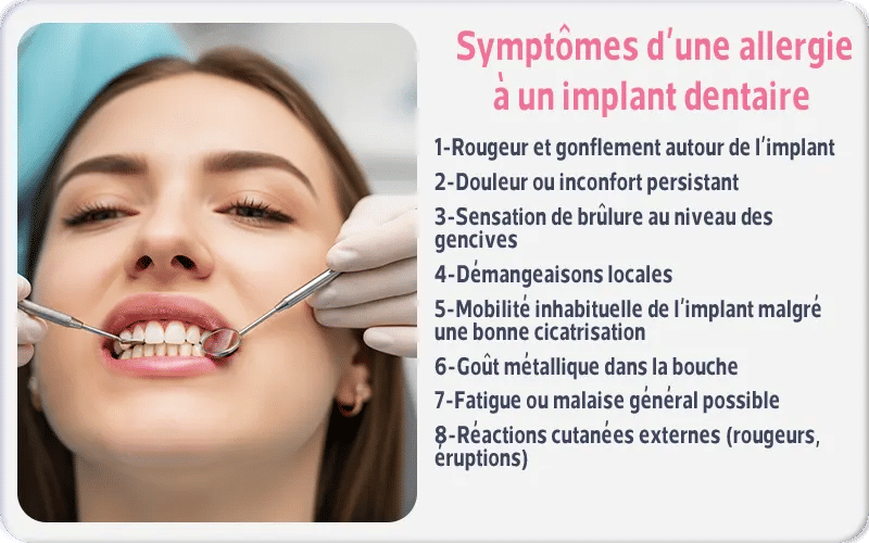 Symptômes d’une allergie à un implant dentaire