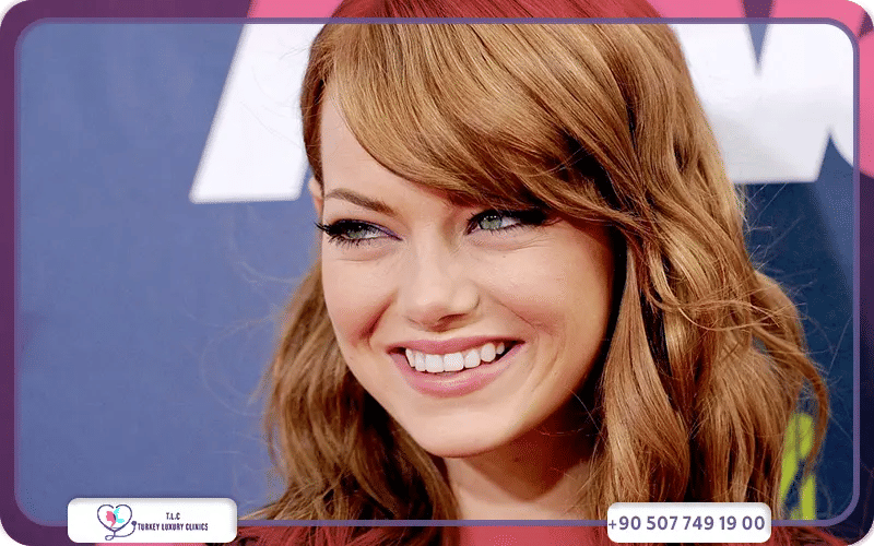 Emma Stone Plastic Surgery
