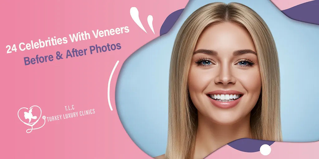 24 Prominente mit Veneers Vorher & Nachher Fotos