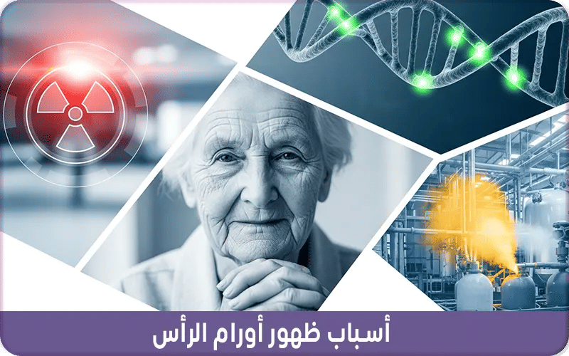 أسباب ظهور أورام الرأس