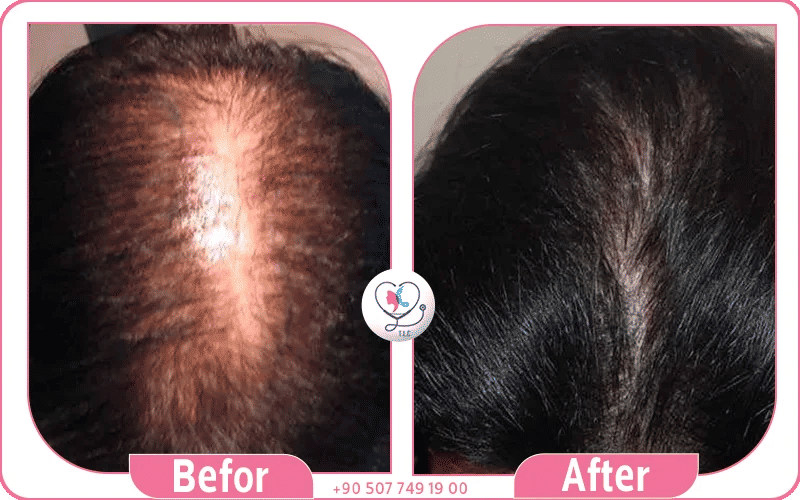 تجربتي مع فراغات الشعر