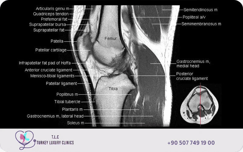 Knee joint MRI anatomy scan showing detailed cross-sectional visualization of bones, cartilage, ligaments, tendons, and muscles around the knee