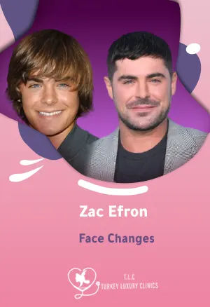 Zac Efron Face Changes: From Injury to Remarkable New Look
