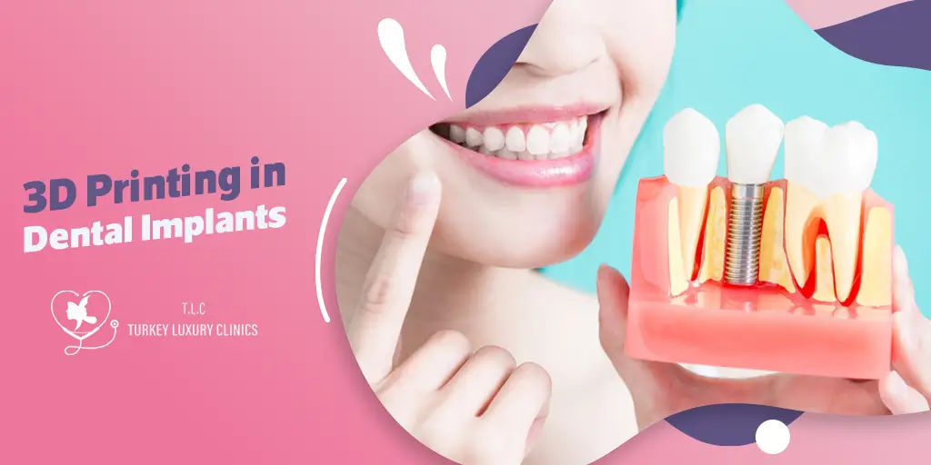 Implantes Dentales Impresos en 3D en Turquía