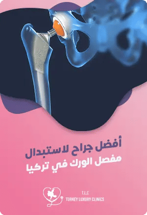 أفضل جراح لاستبدال مفصل الورك في تركياfeatured image