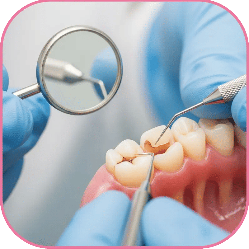 Can Tooth Filling Be Done Without Injection?