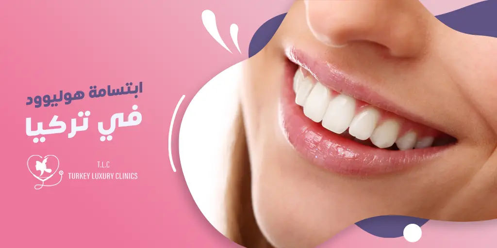 ابتسامة هوليود في تركيا