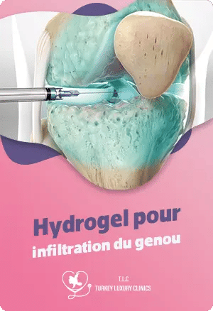 Hydrogel pour infiltration du genoufeatured image