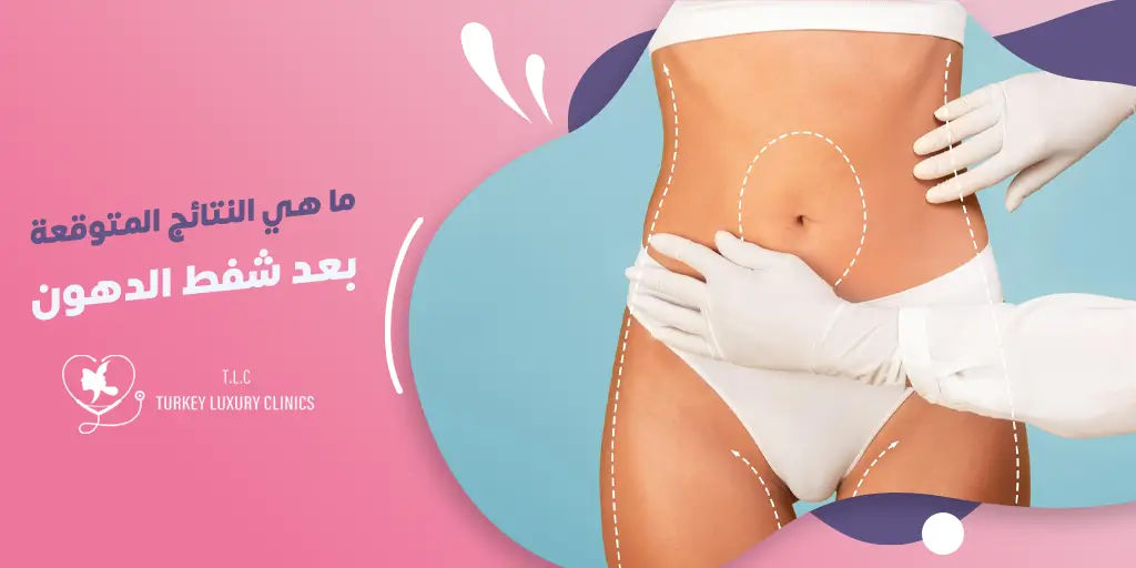 ماهي نتائج شفط الدهون المتوقعة؟