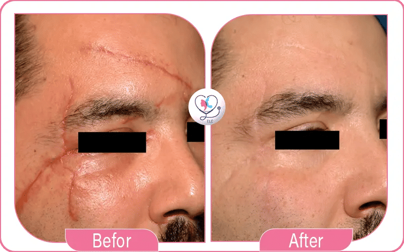 Le déroulement d’une intervention de chirurgie reconstructrice