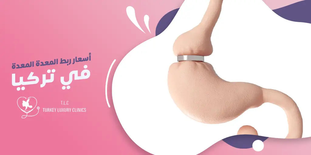تكلفة عملية ربط المعدة في تركيا