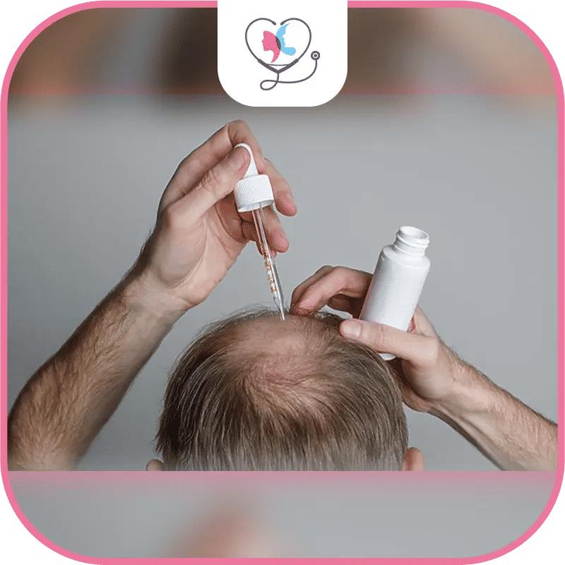 Hair Loss Medication
