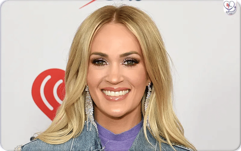 Did Carrie Underwood Have Plastic Surgery?