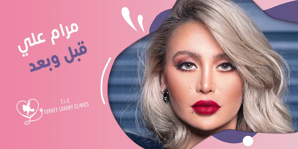 مرام علي قبل وبعد: هل خضعت للتجميل؟ صور قبل وبعد