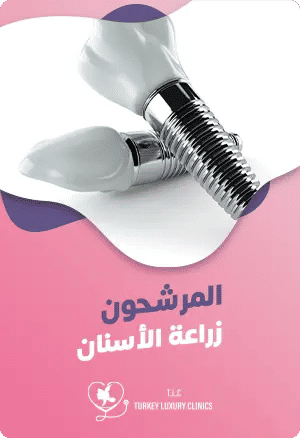 المرشحون لزراعة الأسنانfeatured image