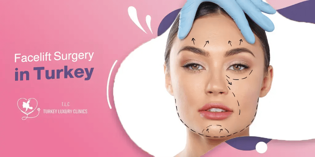 Facelift Surgery in Turkey: 2026 Cost, Best Surgeons & Before and After Results