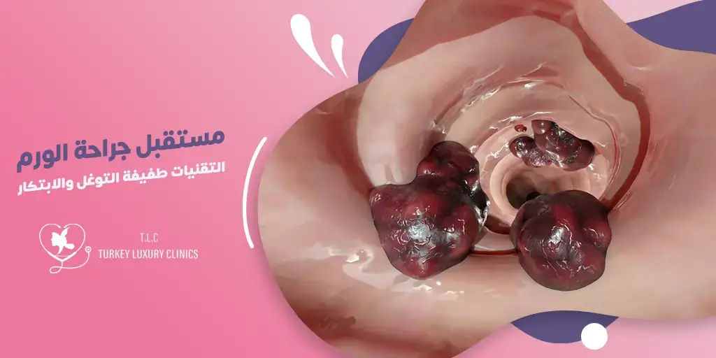مستقبل جراحة الأورام: التقنيات طفيفة التوغل والابتكار