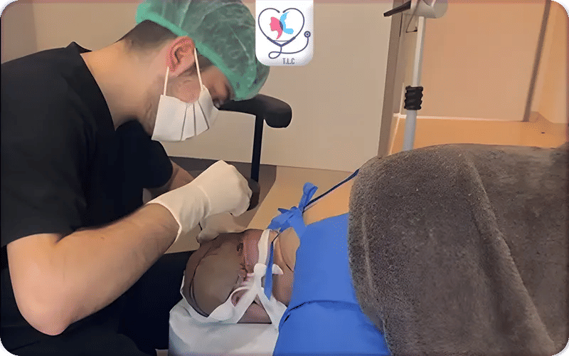 How to Avoid Hair Transplant Mistakes in Turkey