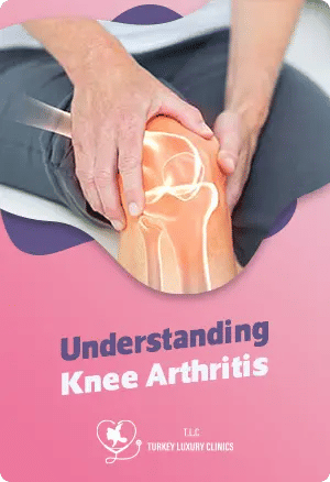 Understanding Knee Arthritis