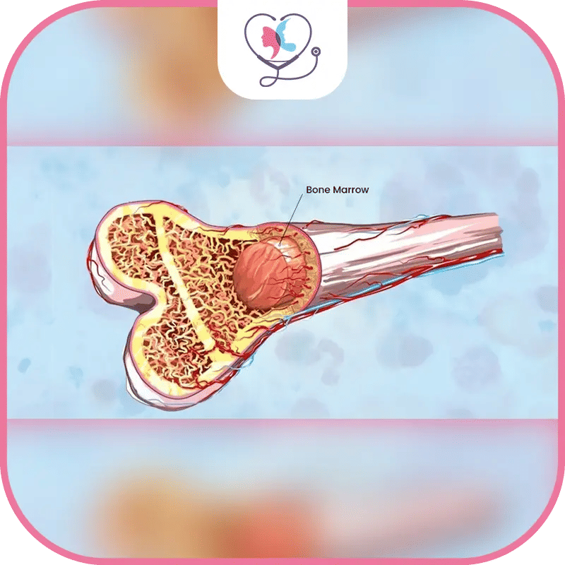 تكلفة زراعة نخاع العظم في تركيا-1772048965924