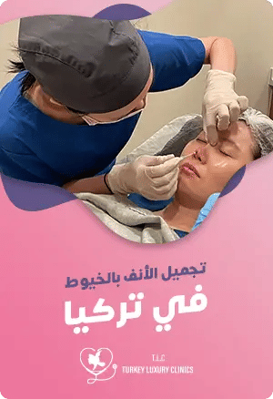 تجميل الانف بالخيوط في تركياfeatured image