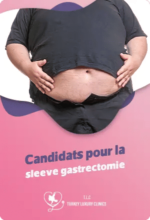 Quand peut-on faire une sleeve : suis-je un bon candidat pour la sleeve gastrectomie ?
