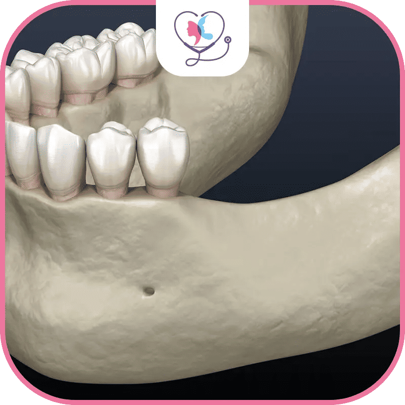 أسباب فقدان العظام في الفك