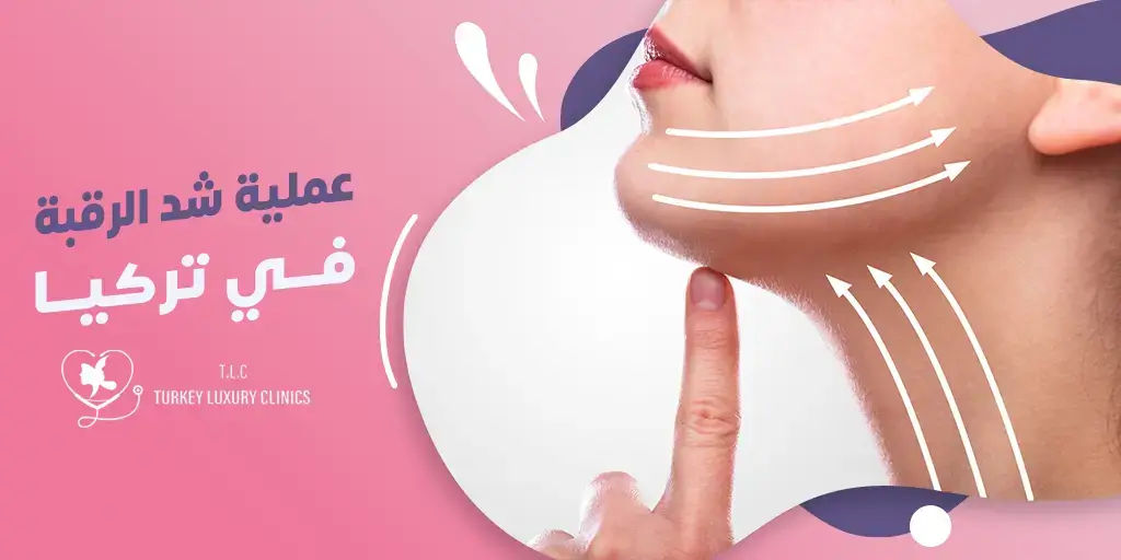 عملية شد الرقبة في تركيا