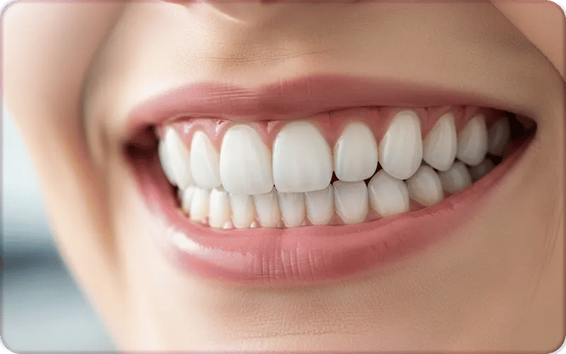 Hollywood Smile Dental Features