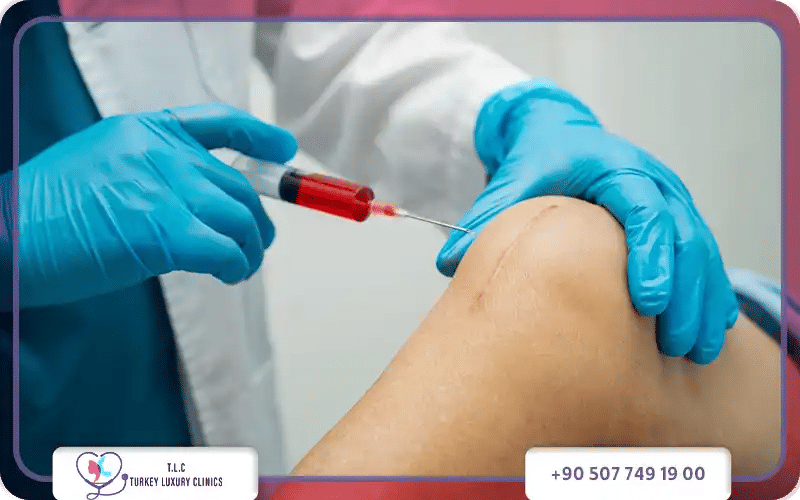 أنواع حقن البلازما للركب