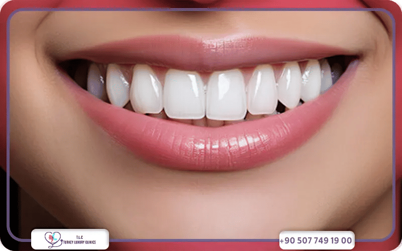 تجميل الأسنان الأمامية الكبيرة