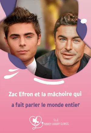 Zac Efron et la mâchoire qui a fait parler le monde entier