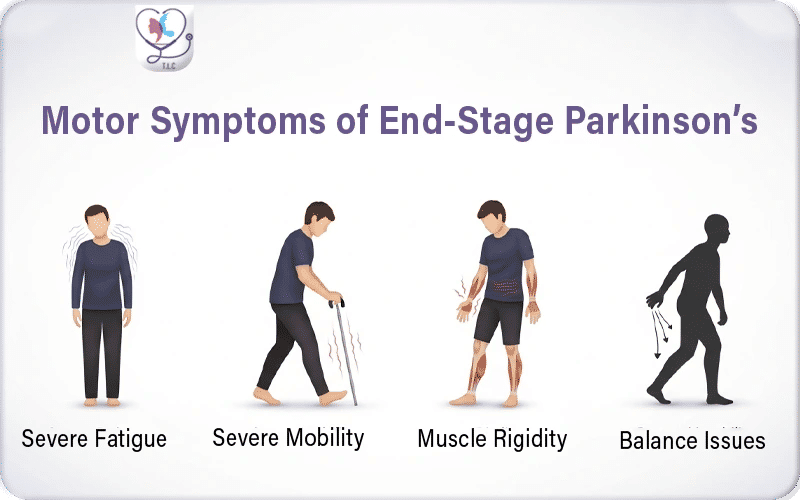 Motor Symptoms of End Stage Parkinson’s