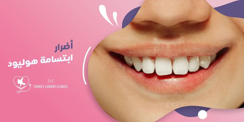 أضرار ابتسامة هوليود