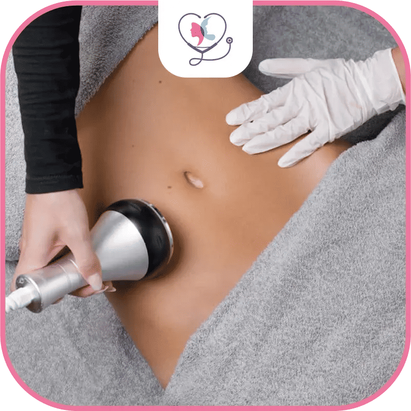 Qu'est-ce que la lipocavitation ?