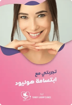 تجربتي مع ابتسامة هوليود featured image