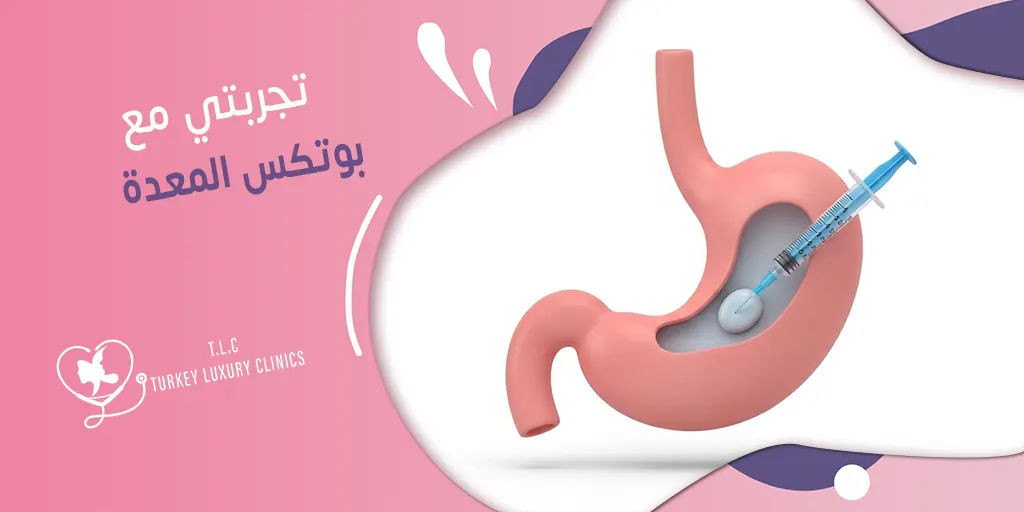 تجربتي مع بوتكس المعدة: حقن المعدة