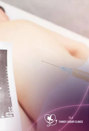 Stem Cell Therapy for Herniated Disc: Success, Candidency & Cost