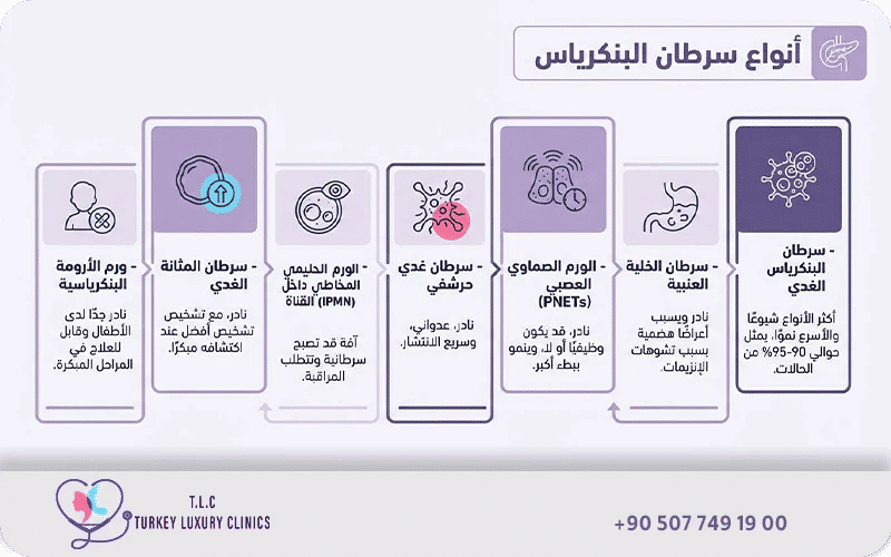 أنواع سرطان البنكرياس