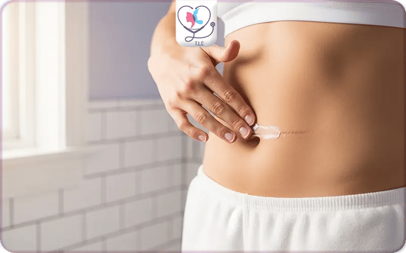 Résultat abdominoplastie 1 an après