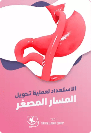 الاستعداد لعملية تحويل المسار المصغرfeatured image