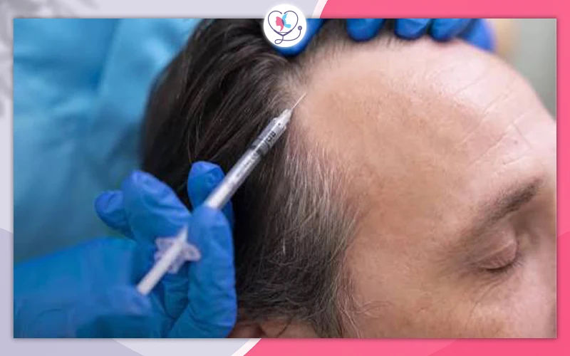 Exosome Injections for Hair Loss and Hair Growth