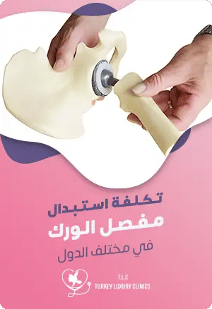 تكلفة استبدال مفصل الورك في مختلف الدولfeatured image