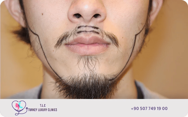 ماهي خطوات زراعة شنب