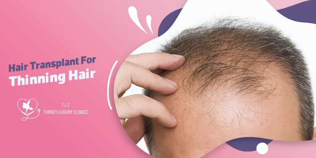Hair Transplant For Thinning Hair