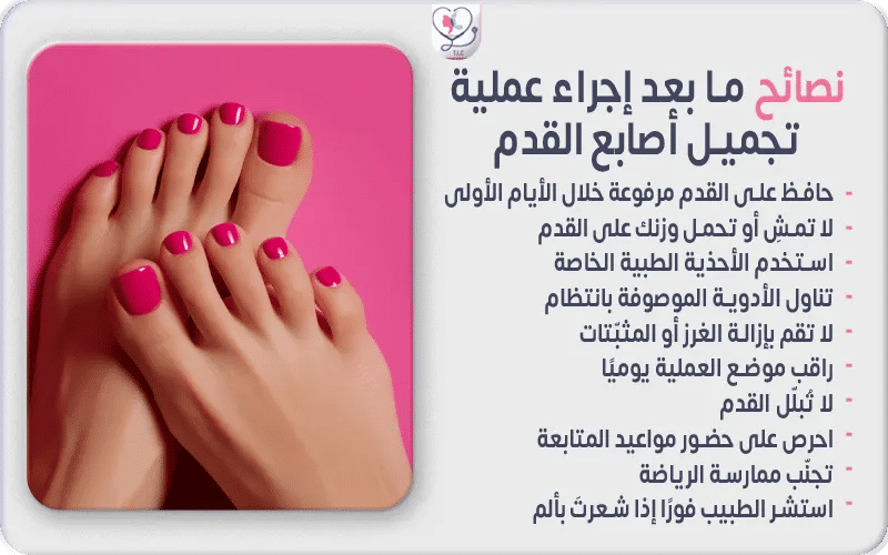 نصائح ما بعد إجراء عملية تجميل أصابع القدم