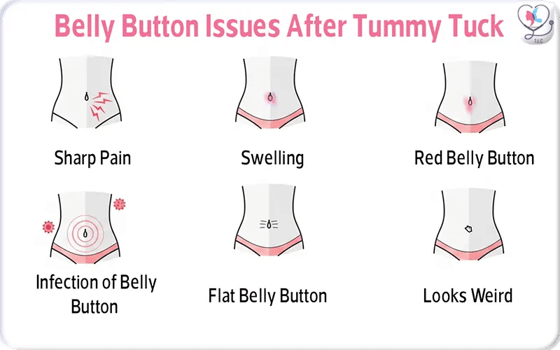 Belly Button Issues After Tummy Tuck