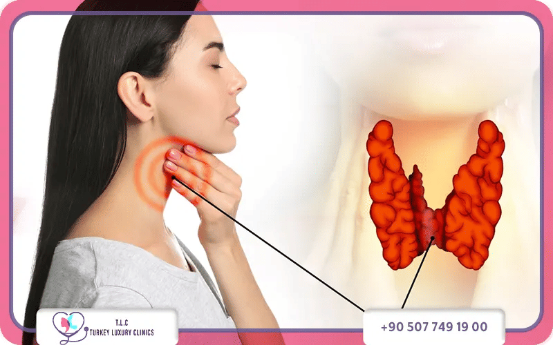 ما الخطة العلاجية التي وُضعت لها؟