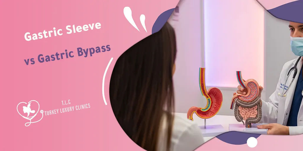 Magenbande vs. Magenbypass: Welche ist besser?